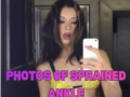 KATSEYE’s Megan Shows Bare Sprained Ankle on Live Stream After Dublin Show